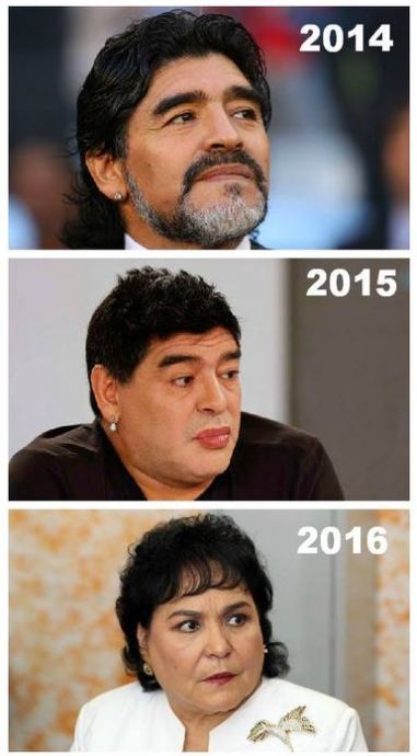 Maradona, dopo il lifiting sembra… Moira Orfei. Le foto