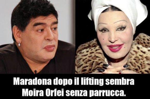 Maradona, dopo il lifiting sembra… Moira Orfei. Le foto