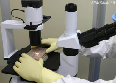 Chemioterapia: cuffia contro caduta dei capelli