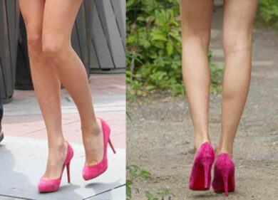 Gambe belle e sane, 8 consigli dell’esperto