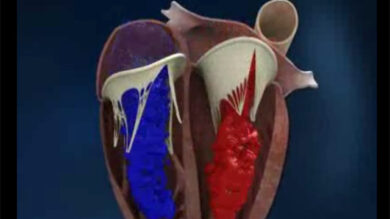 Cuore, lo scompenso cardiaco uccide 3 volte in più dei tumori