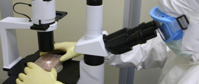 Tumori: un ‘ammorbidente’ per eliminare resistenza alla chemio