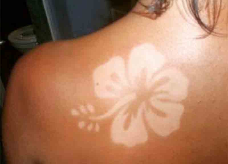 Abbronzatura, l’ultima tendenza? La “sunburn art”. Ma è allarme Abbronzatura, l’ultima tendenza? La “sunburn art”. Ma è allarme