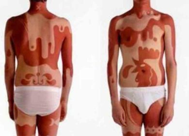 Abbronzatura, l’ultima tendenza? La “sunburn art”. Ma è allarme
