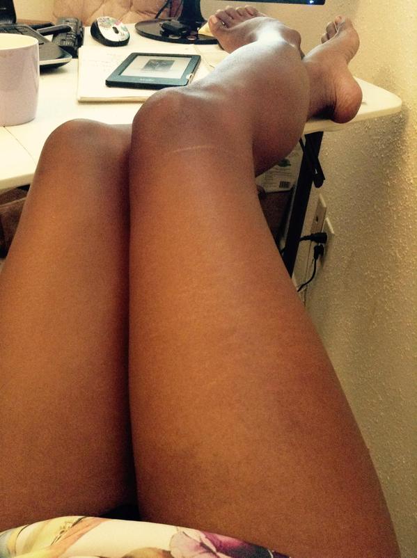 #ThighReading, smagliature e cellulite diventano social #ThighReading, smagliature e cellulite diventano social