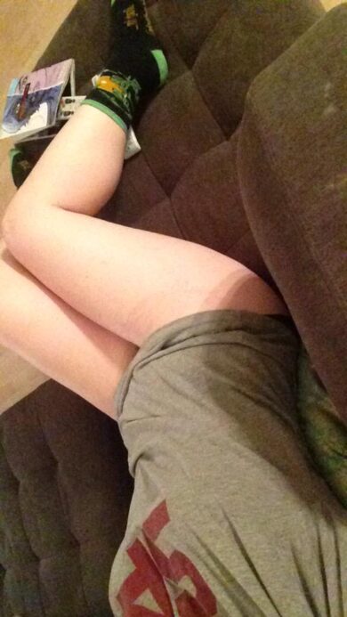 #ThighReading, smagliature e cellulite diventano social