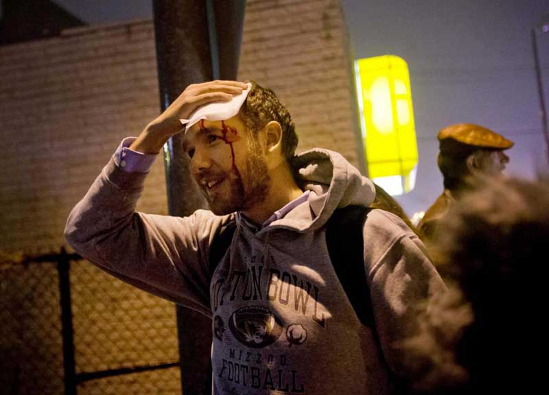 Usa: polizia spara, ucciso 15enne afroamericano