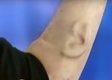 Un orecchio nel braccio per connettersi a internet