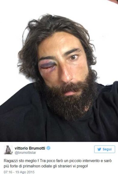 Brumotti picchiato in strada insieme al padre. Video