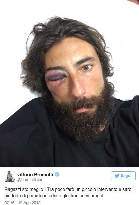 Denunciato anche Brumotti. E Giorgia Palmas lo difende