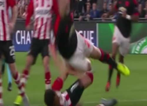 Manchester United, dramma per Luke Shaw: deve operarsi nuovamente Manchester United, dramma per Luke Shaw: deve operarsi nuovamente