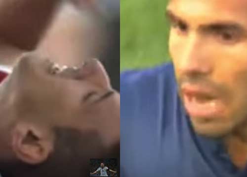 Tevez rompe tibia e perone a Ezequiel Ham durante Boca-Argentinos Tevez rompe tibia e perone a Ezequiel Ham durante Boca-Argentinos