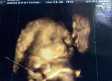 Ecografia choc: nella pancia anche il nonno defunto