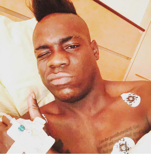 Milan, Balotelli operato a Monaco. Ecco i tempi di recupero Milan, Balotelli operato a Monaco. Ecco i tempi di recupero
