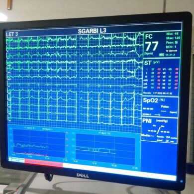 Sgarbi, su Facebook la foto dell’elettrocardiogramma: ‘Tutto bene’