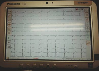Emergenze cardiologiche e diagnostica telematica: come funzionano?