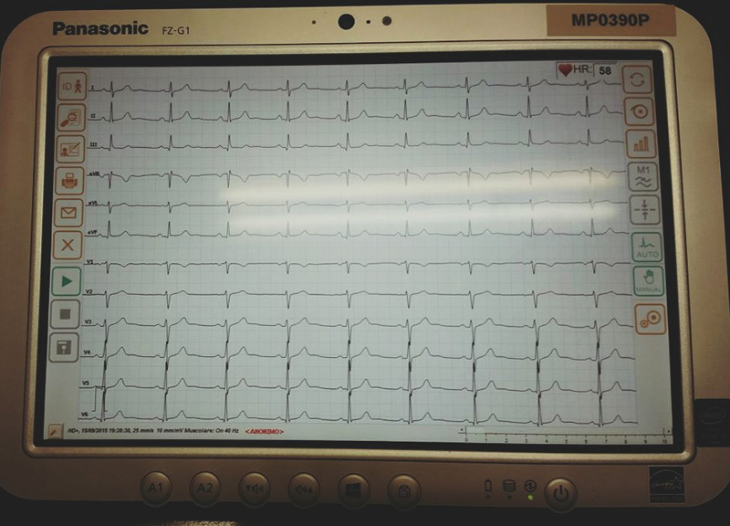 Emergenze cardiologiche e diagnostica telematica: come funzionano? Emergenze cardiologiche e diagnostica telematica: come funzionano?