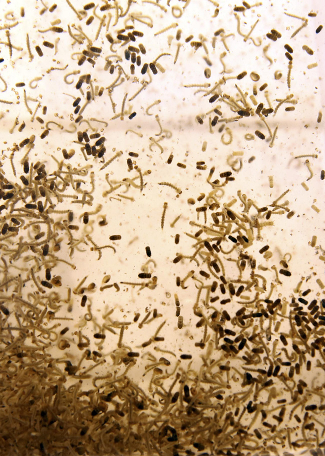 Allarme Zika a Roma. Infetto, era stato in Brasile Allarme Zika a Roma. Infetto, era stato in Brasile