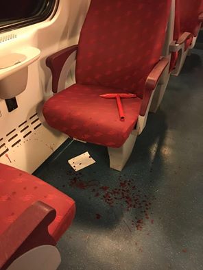 Aggredita con un martello in treno: Sara ancora ricoverata