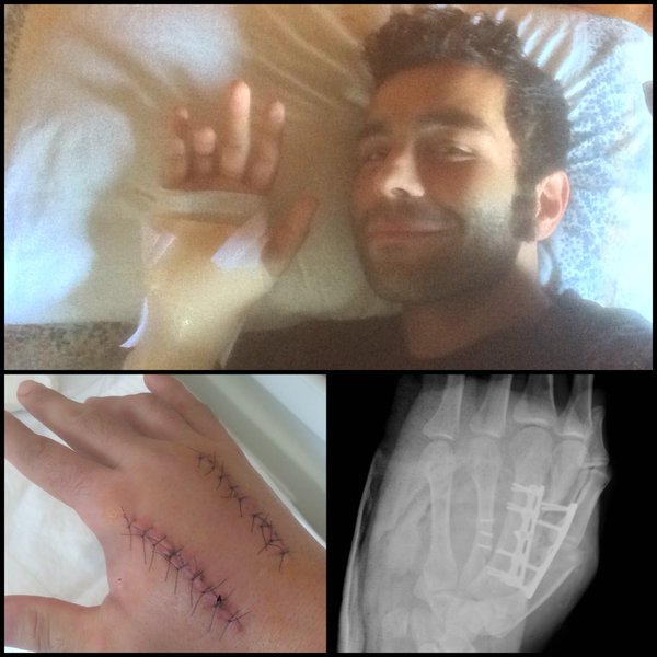 MotoGP, Petrucci (Ducati) e la mano operata: “Non sono i 20 punti che volevo” MotoGP, Petrucci (Ducati) e la mano operata: “Non sono i 20 punti che volevo”