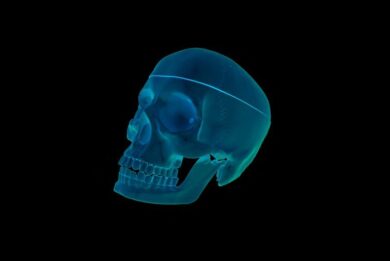 Radiazioni mediche quintuplicate in 5 anni. RADIAZIONI MEDICHE, cosa cambia