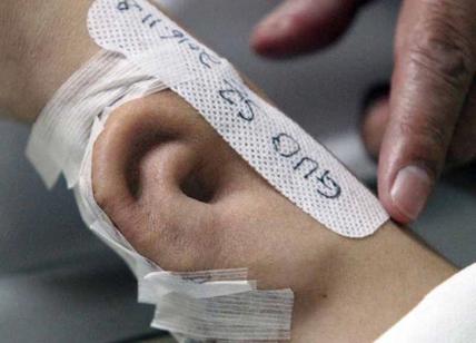 Orecchio trapiantato nel braccio. Foto-video dell’orecchio nel braccio Orecchio trapiantato nel braccio. Foto-video dell’orecchio nel braccio