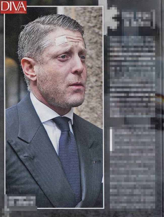 Lapo Elkann malinconico e solo: prima uscita pubblica dopo lo scandalo. Foto Lapo Elkann malinconico e solo: prima uscita pubblica dopo lo scandalo. Foto