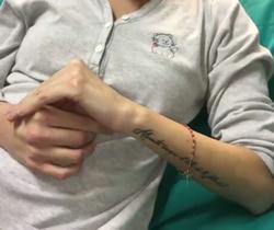 Gessica Notaro sfregiata con l’acido: “Mi mi date la carica”. GESSICA VIDEO