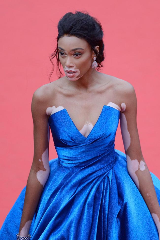Winnie Harlow, la modella con la vitiligine. Cannes, speciale red carpet Winnie Harlow, la modella con la vitiligine. Cannes, speciale red carpet