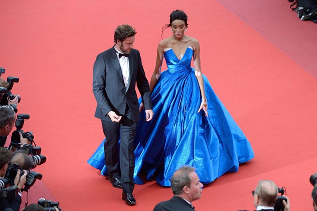 Winnie Harlow, la modella con la vitiligine. Cannes, speciale red carpet Winnie Harlow, la modella con la vitiligine. Cannes, speciale red carpet