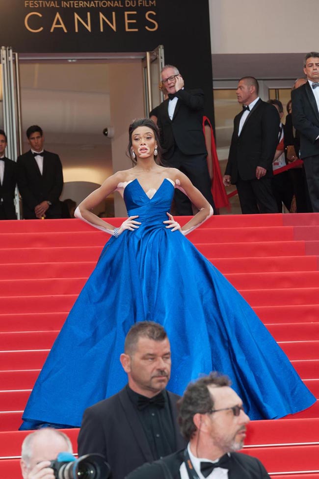 Winnie Harlow, la modella con la vitiligine. Cannes, speciale red carpet Winnie Harlow, la modella con la vitiligine. Cannes, speciale red carpet