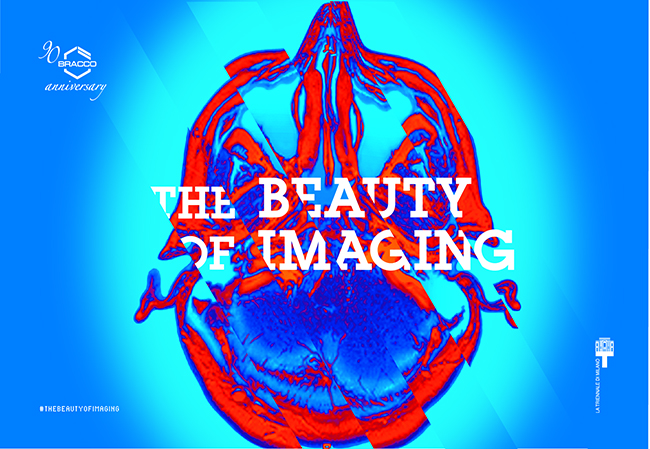 Per i 90 anni di Bracco, apre la mostra “The Beauty of Imaging” Per i 90 anni di Bracco, apre la mostra “The Beauty of Imaging”