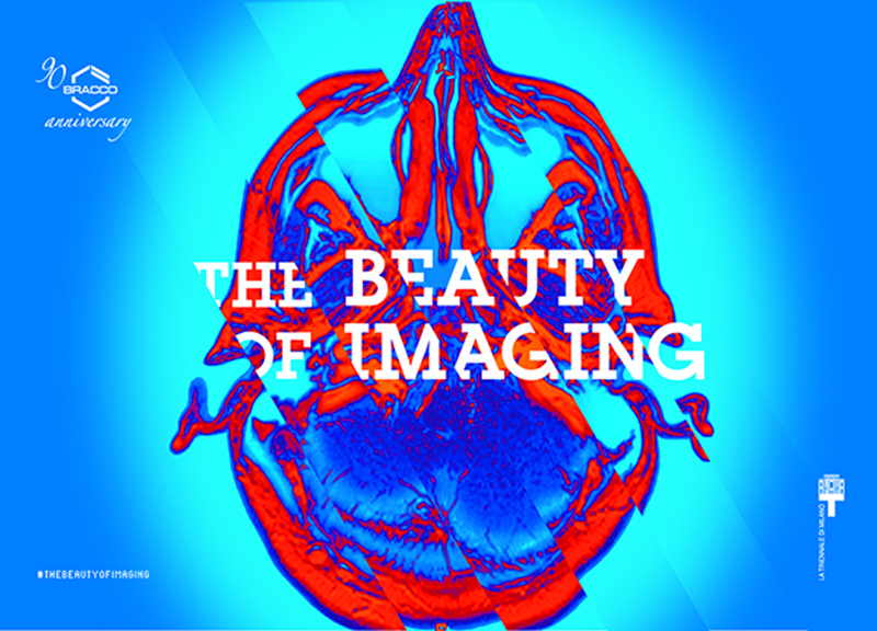Per i 90 anni di Bracco, apre la mostra “The Beauty of Imaging” Per i 90 anni di Bracco, apre la mostra “The Beauty of Imaging”