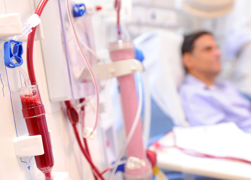 Malattie renali: un milione di morti l’anno, una persona su 10 ne soffre Malattie renali: un milione di morti l’anno, una persona su 10 ne soffre