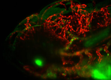Con un cancro alla gola, radioterapia dopo 3 mesi. Lazio, sanità allo sbando