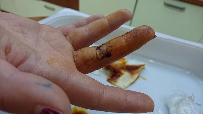 Piazza San Carlo, parla un ferito: “Quella sera ho creduto di morire” – FOTO