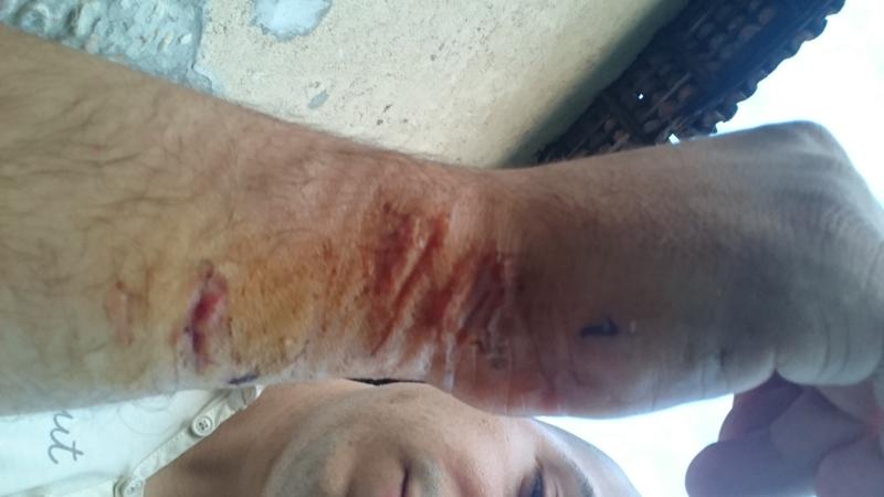 Piazza San Carlo, parla un ferito: “Quella sera ho creduto di morire” – FOTO