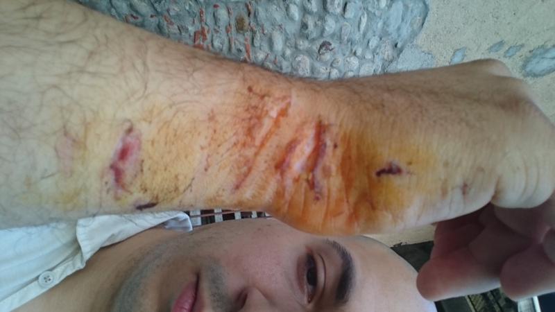 Piazza San Carlo, parla un ferito: “Quella sera ho creduto di morire” – FOTO