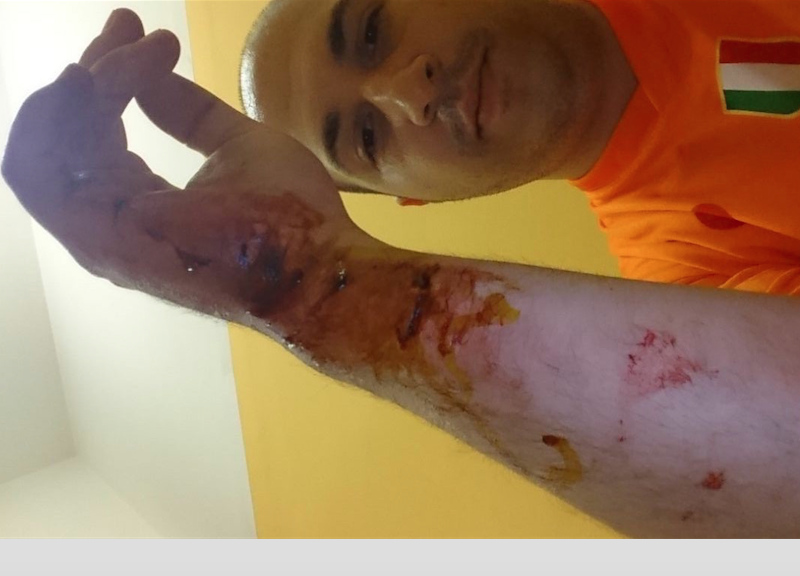 Piazza San Carlo, parla un ferito: “Quella sera ho creduto di morire” – FOTO