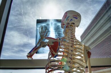 Colesterolo buono è “cattivo”: fa morire prima. COLESTEROLO SCOPERTA CHOC