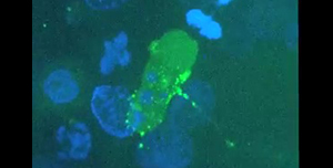 Hiv, come il virus Hiv infetta le cellule