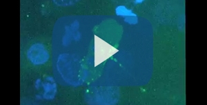 HIV: video mostra come virus HIV infetta le cellule durante il sesso