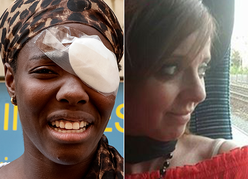 Daisy, ma quale attacco razzista. Brunella colpita, nessuno protesta Daisy, ma quale attacco razzista. Brunella colpita, nessuno protesta