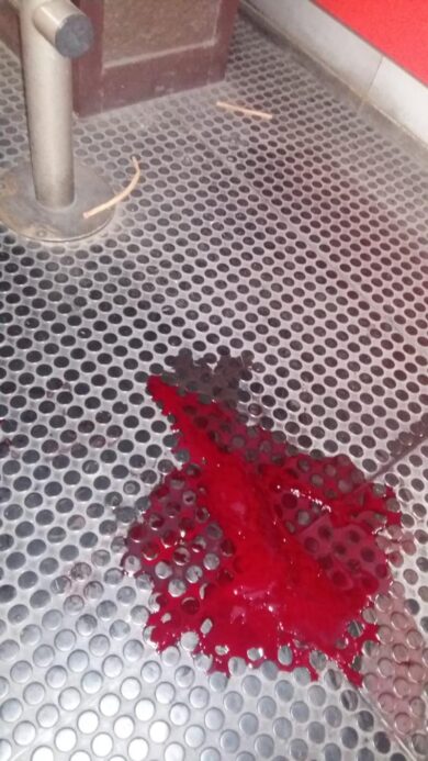 Atm, mattatoio a Pasteur: prima la fuga, poi le coltellate. FOTO