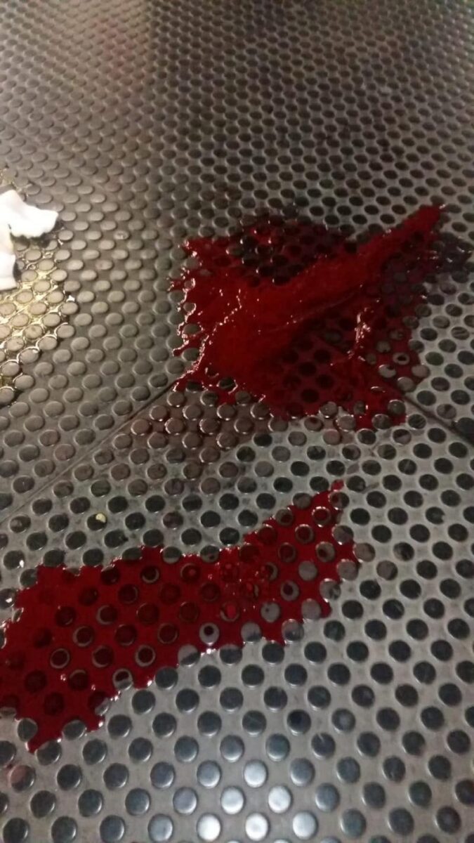 Atm, mattatoio a Pasteur: prima la fuga, poi le coltellate. FOTO Atm, mattatoio a Pasteur: prima la fuga, poi le coltellate. FOTO