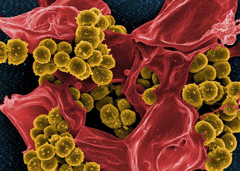 Lavarsi le mani? Attenti pure ad asciugarle: il getto d’aria culla di batteri Lavarsi le mani? Attenti pure ad asciugarle: il getto d’aria culla di batteri