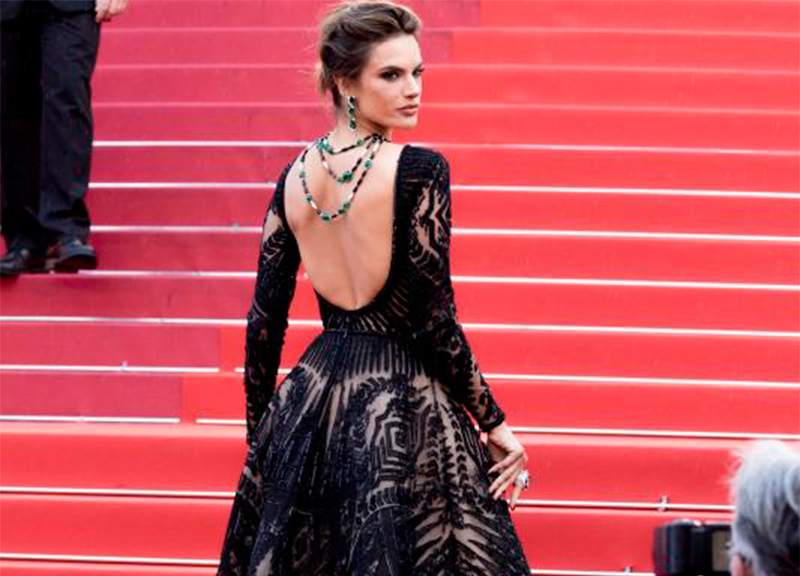 Winnie Harlow, la top con la vitiligine, conquista le passerelle. FOTO