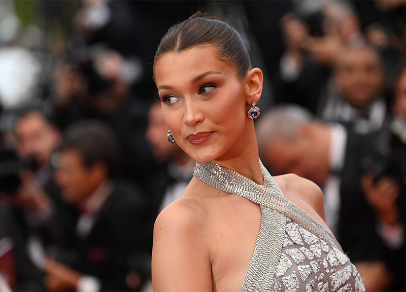 Winnie Harlow, la top con la vitiligine, conquista le passerelle. FOTO