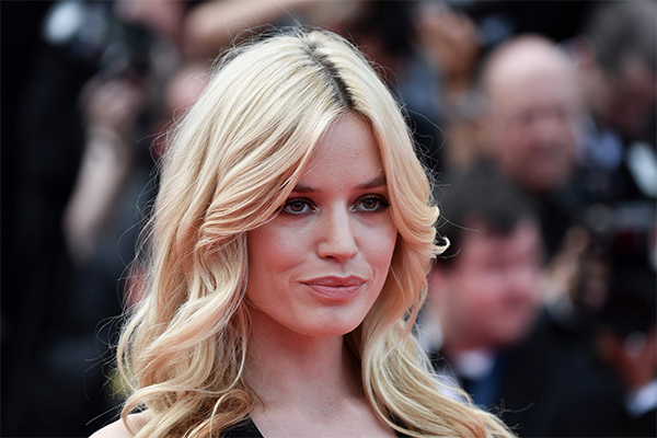 Winnie Harlow, la top con la vitiligine, conquista le passerelle. FOTO