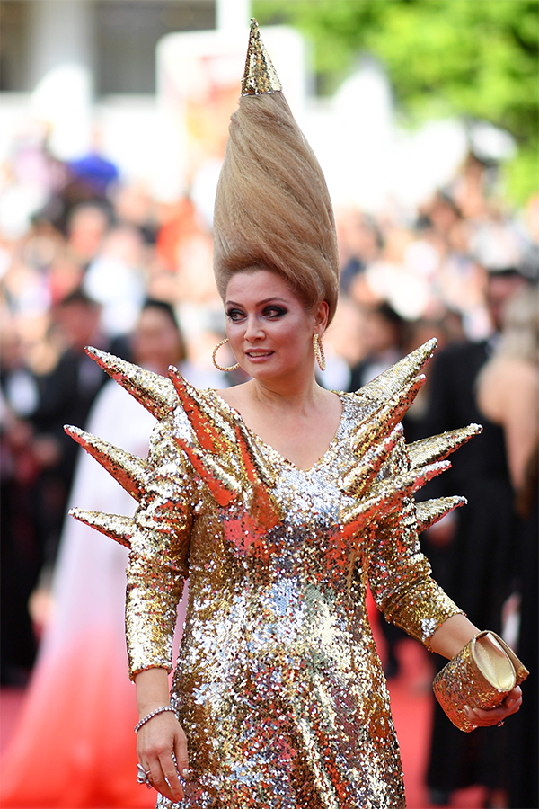 Winnie Harlow, la top con la vitiligine, conquista le passerelle. FOTO